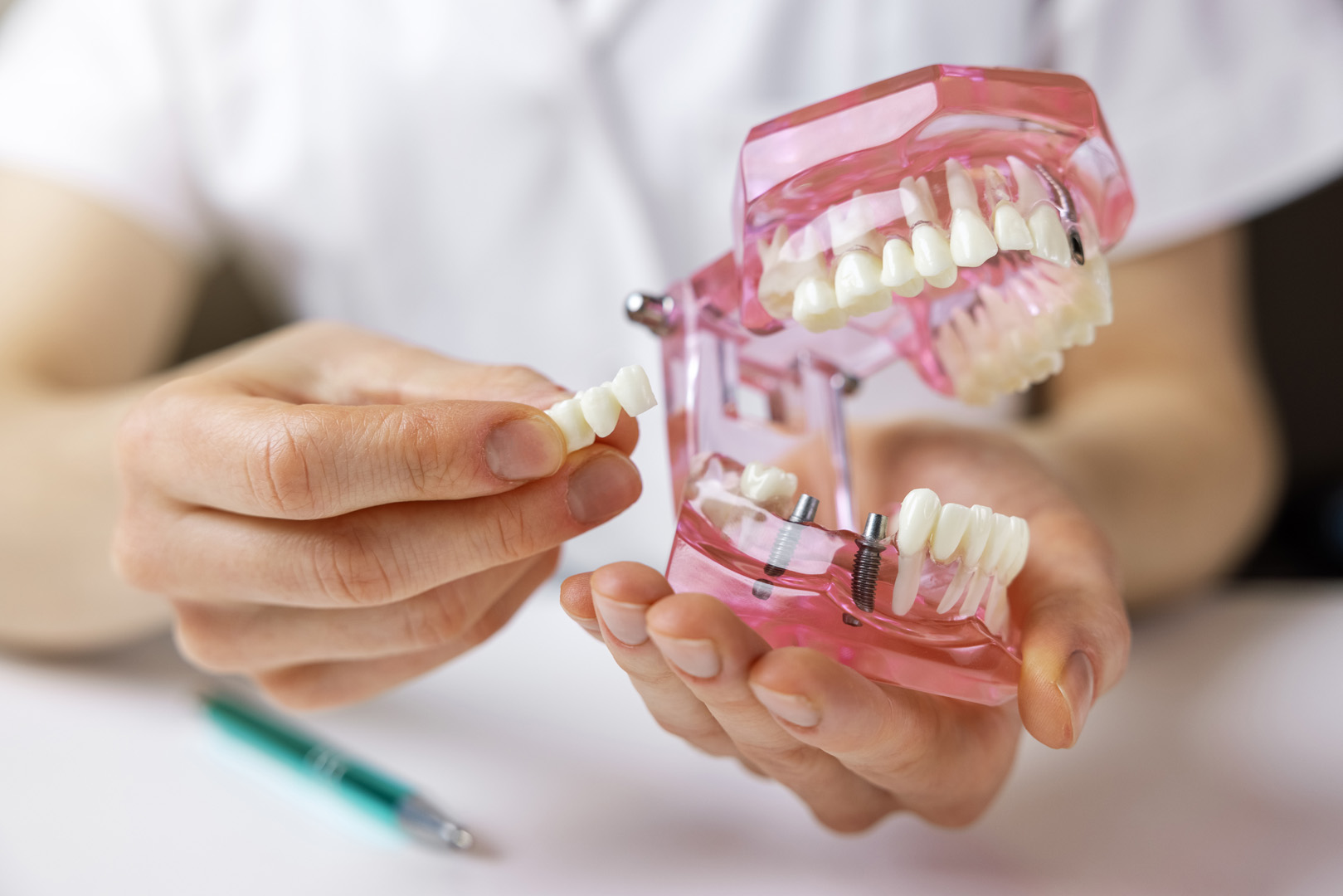 Dental Bridges in Memorial, Houston